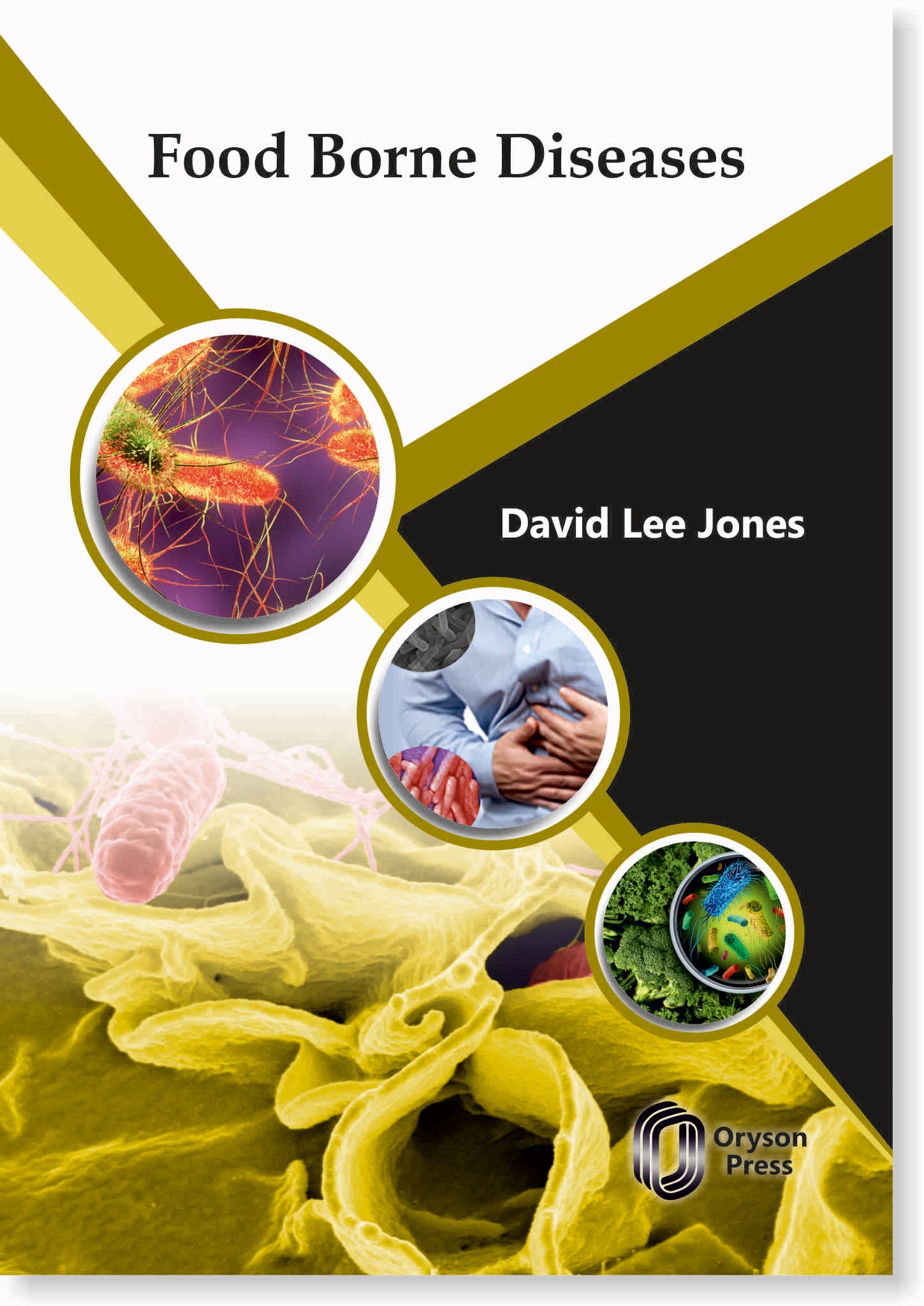 Food Borne Diseases
